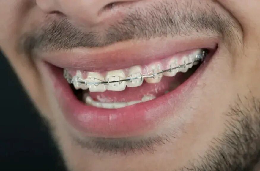 ������� � ������� ������: ��������� ���� � ��������� ����������