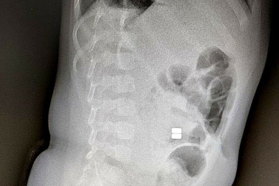 �������� ����� ���� �������: ���� �������� �� ������������� ���� ��-�� ����, ��� ������� ��������� ������