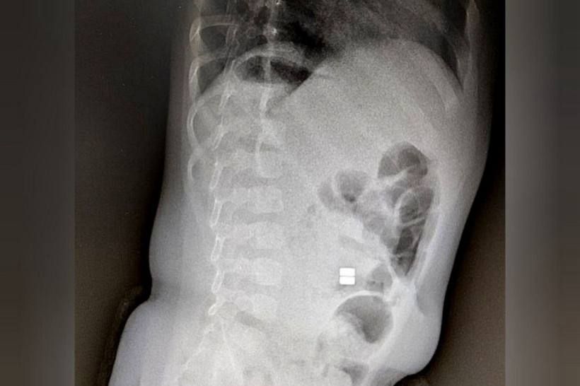 �������� ����� ���� ������� ��-�� ����� �������� ����������� �� ��������� �������������