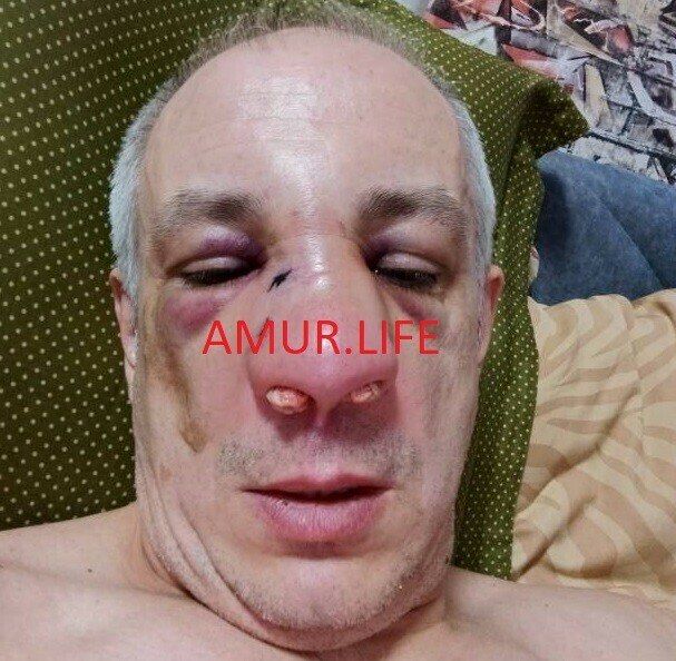 � ������������� ������� ������ �� ������ ��������� ��������� �� ������� ����� ����������