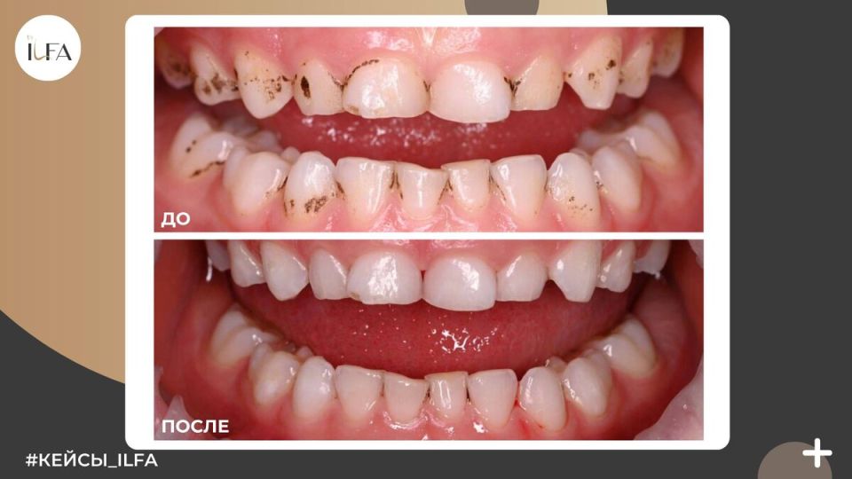 Проблема налёта Пристли: что нужно знать и как справиться